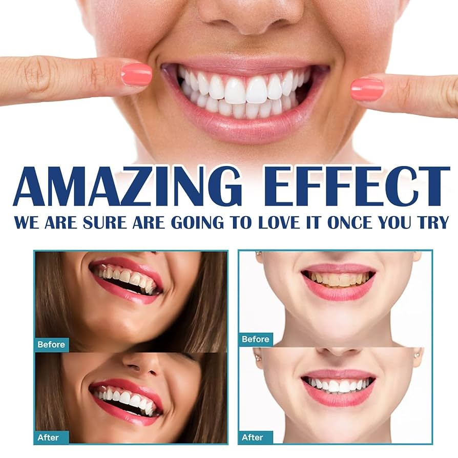Teeth Whitening Stickers Mint  - Teeth Whitening Gel Refills 리뷰 및 가격