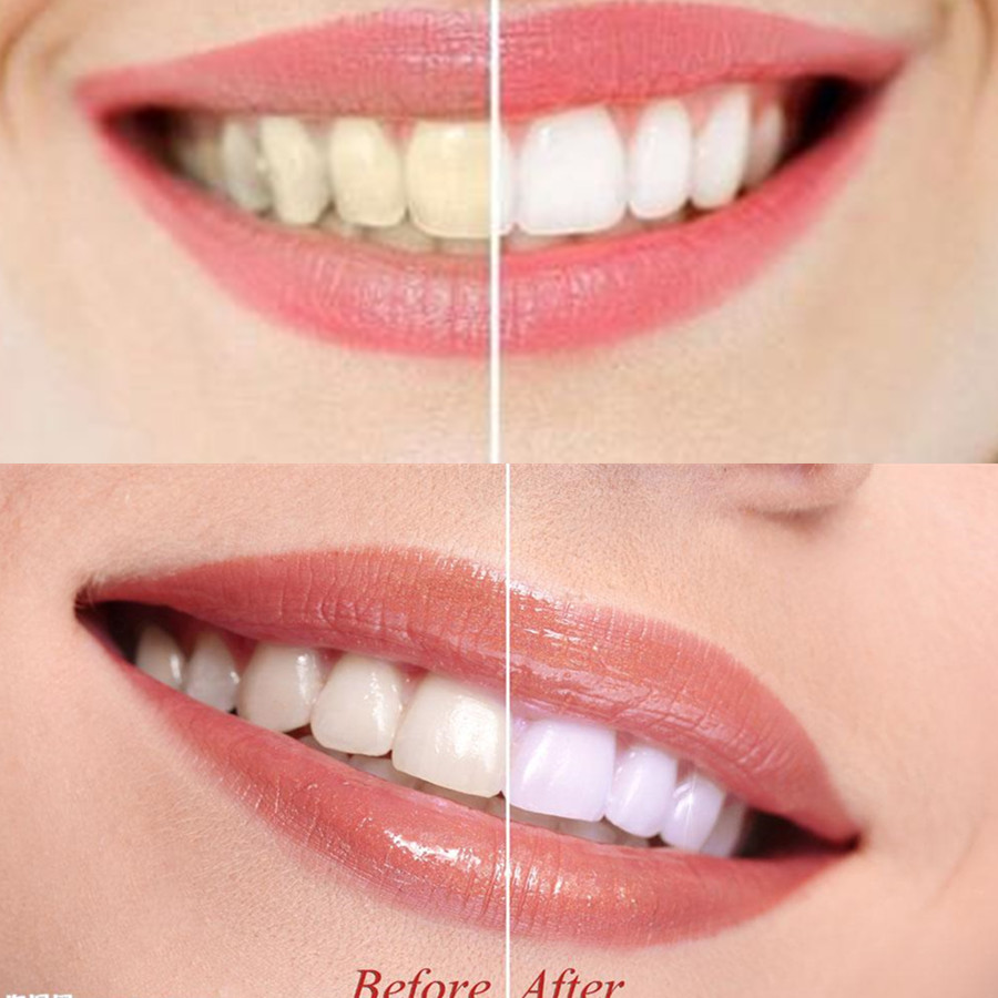 Bamboo Charcoal Teeth Tooth De - Teeth Whitening Flash 리뷰 및 가격