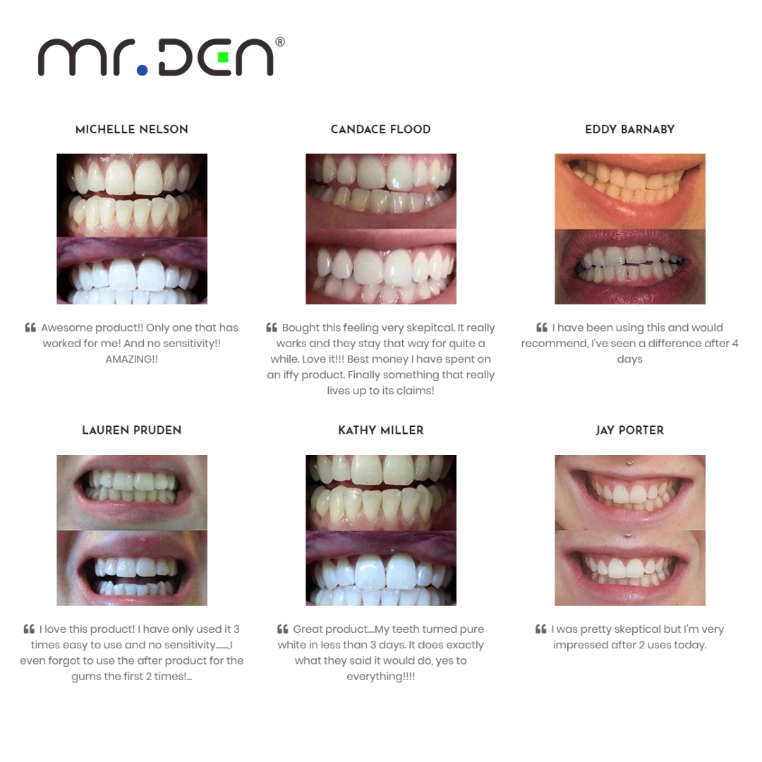 Dr. Whiten 3 Pack Teeth Whiten - Teeth Whitening Professional 리뷰 및 가격