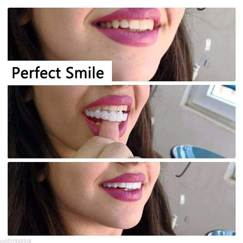 Veneer Snap-on Teeth Kit Fake  - Teeth Whitening Vape 리뷰 및 가격