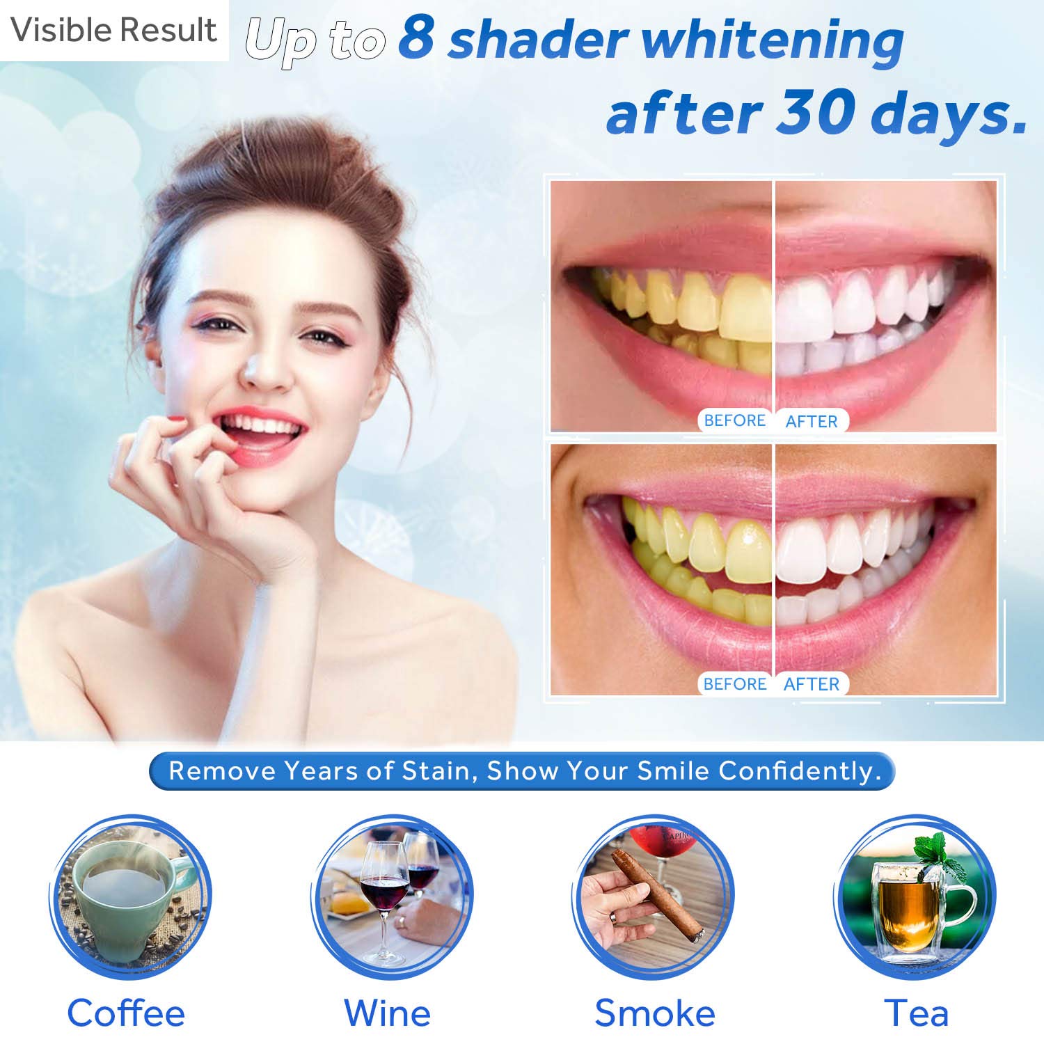 Teeth Whitening Gel Refill Syr - Teeth Whitening Gel Refills 리뷰 및 가격