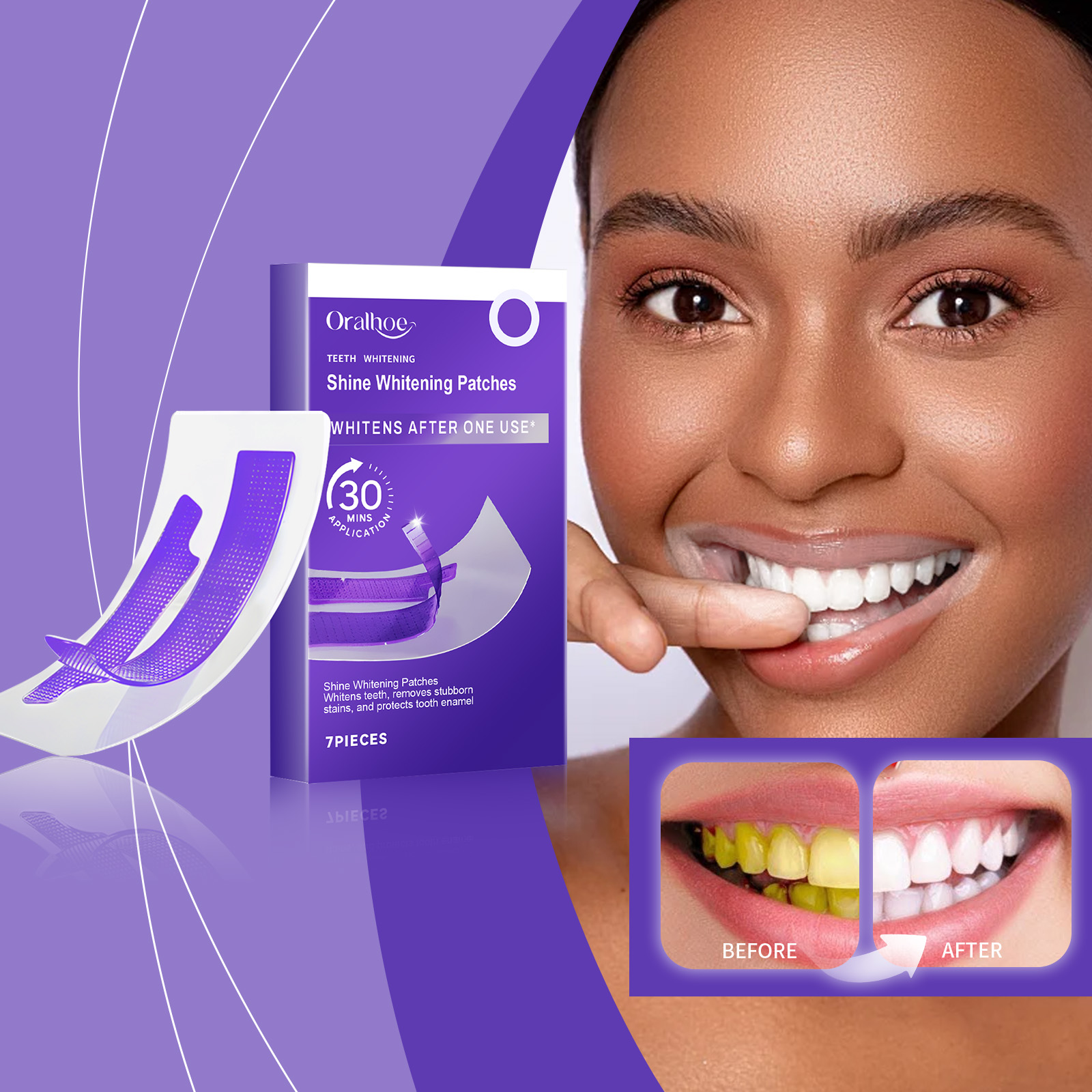 Purple Teeth Whitening Strips  - Teeth Whitening Strips Crest 리뷰 및 가격