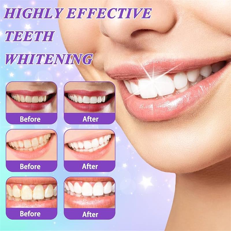 9D Purple Teeth Whitening Toot - Teeth Whitening Natural 리뷰 및 가격