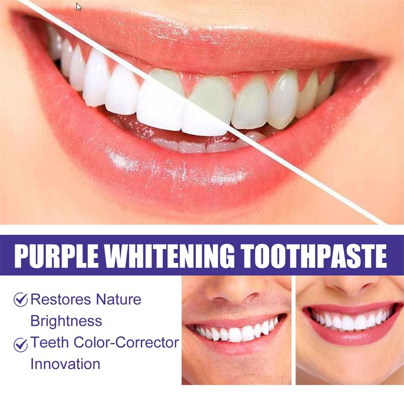 9D Purple Teeth Whitening Toot - Teeth Whitening Natural 리뷰 및 가격