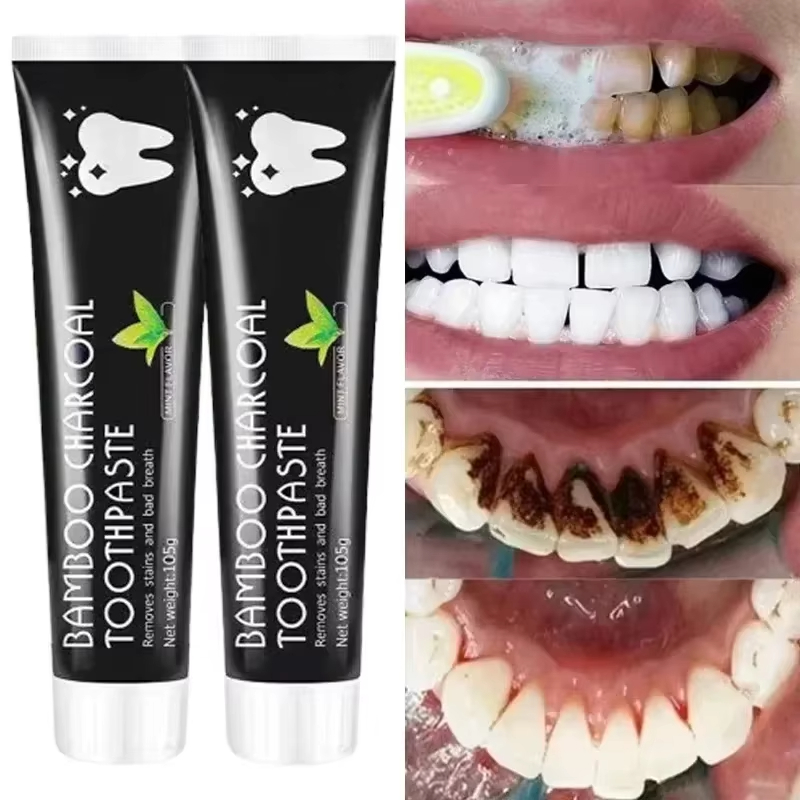 Whitening Toothpaste Bamboo Ch - Teeth Whitening Street 리뷰 및 가격