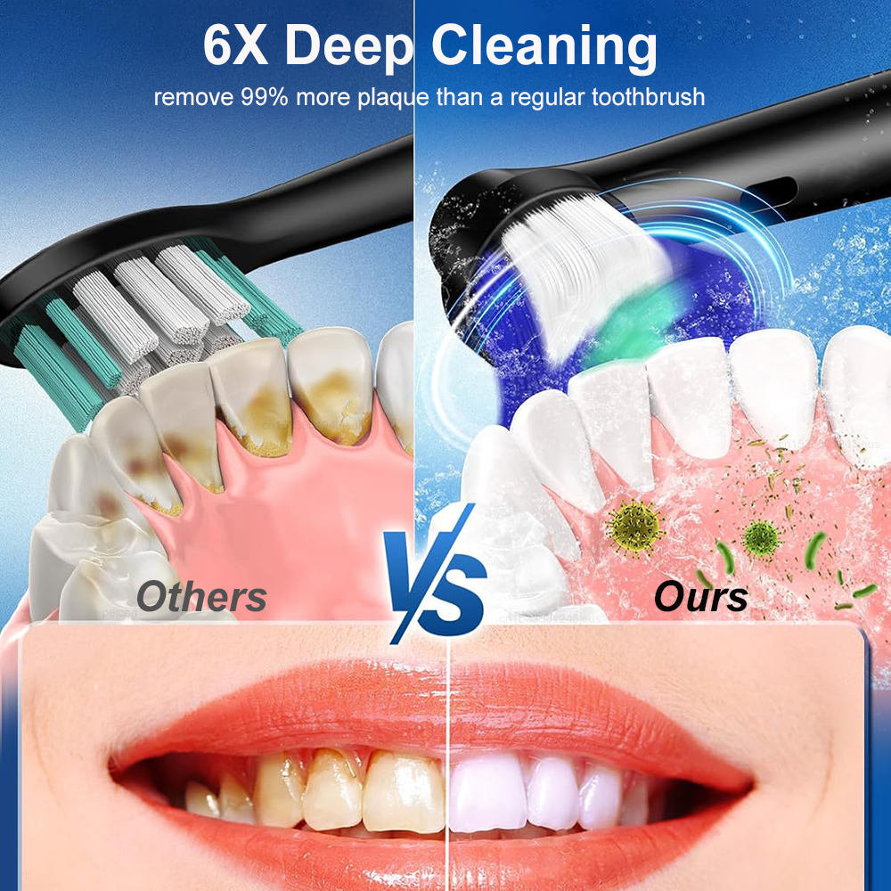 Electric Rotating Toothbrush D - Teeth Whitening Gel Refills 리뷰 및 가격