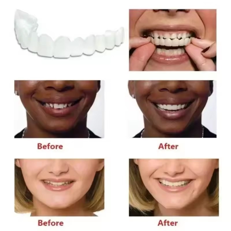 Teeth Veneers Whitening Dentur - Teeth Whitening Vape 리뷰 및 가격