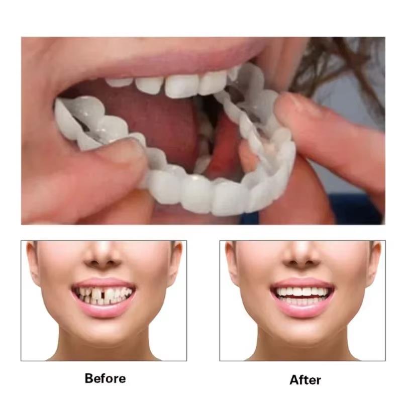 Best Sellers  Teeth Kit Fake T - Teeth Whitening Vape 리뷰 및 가격