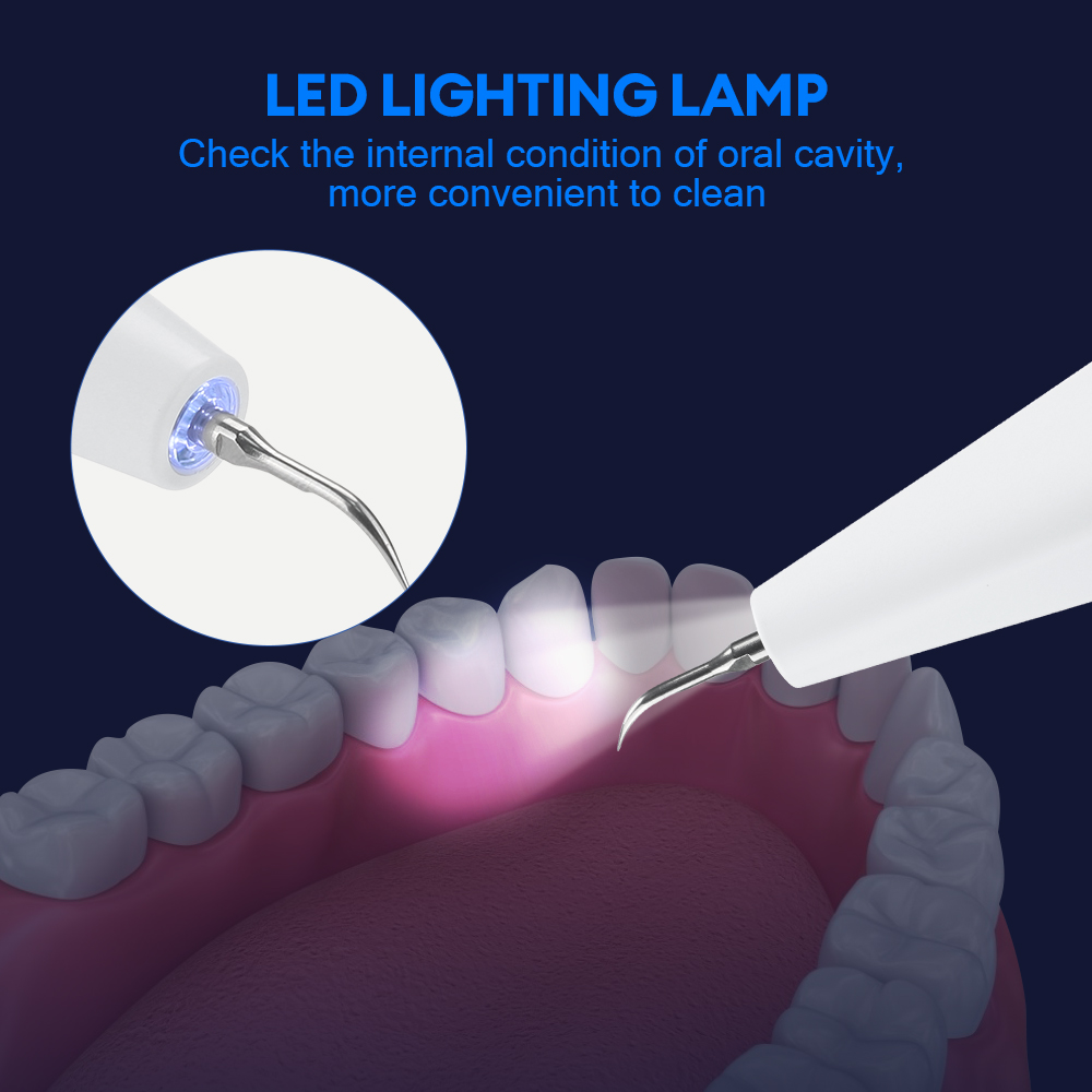 Ultrasonic Dental Calculus Rem - Teeth Whitening Professional 리뷰 및 가격