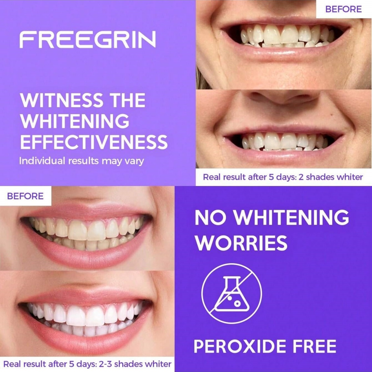Deluxe Whitening Teeth Sticker - Teeth Whitening Gel Refills 리뷰 및 가격
