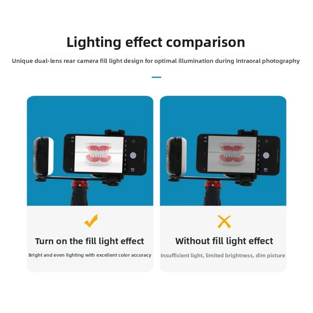 Dental Photography Light, Blue - Teeth Whitening Flash 리뷰 및 가격