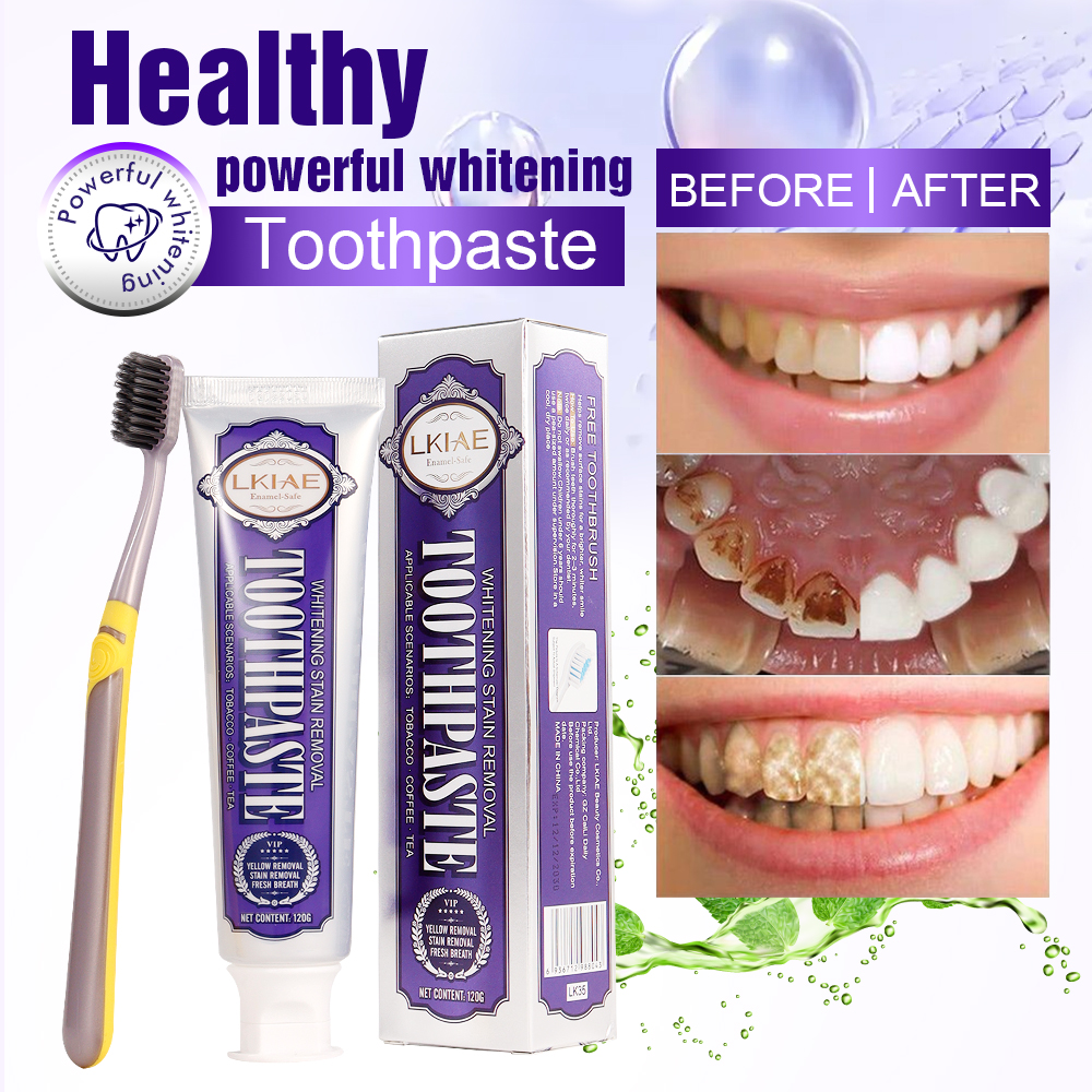 LKIAE White Teeth Whitening To - Teeth Whitening Natural 리뷰 및 가격