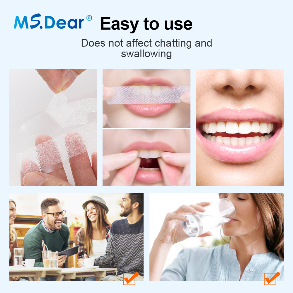 Teeth Whitening Strips Cleansi - Teeth Whitening Gel Refills 리뷰 및 가격